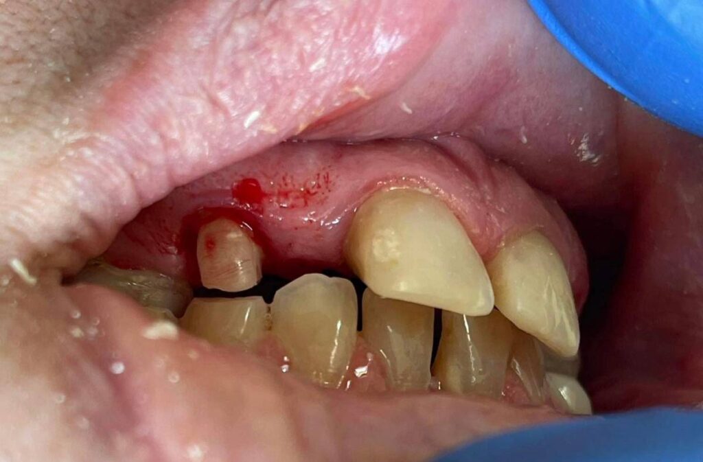 agnieszka dudzinska protetyk stomatologiczny olsztyn 01