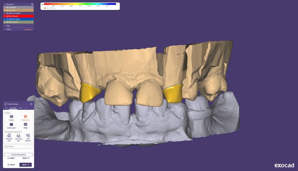 agnieszka dudzinska protetyk stomatologiczny olsztyn 03