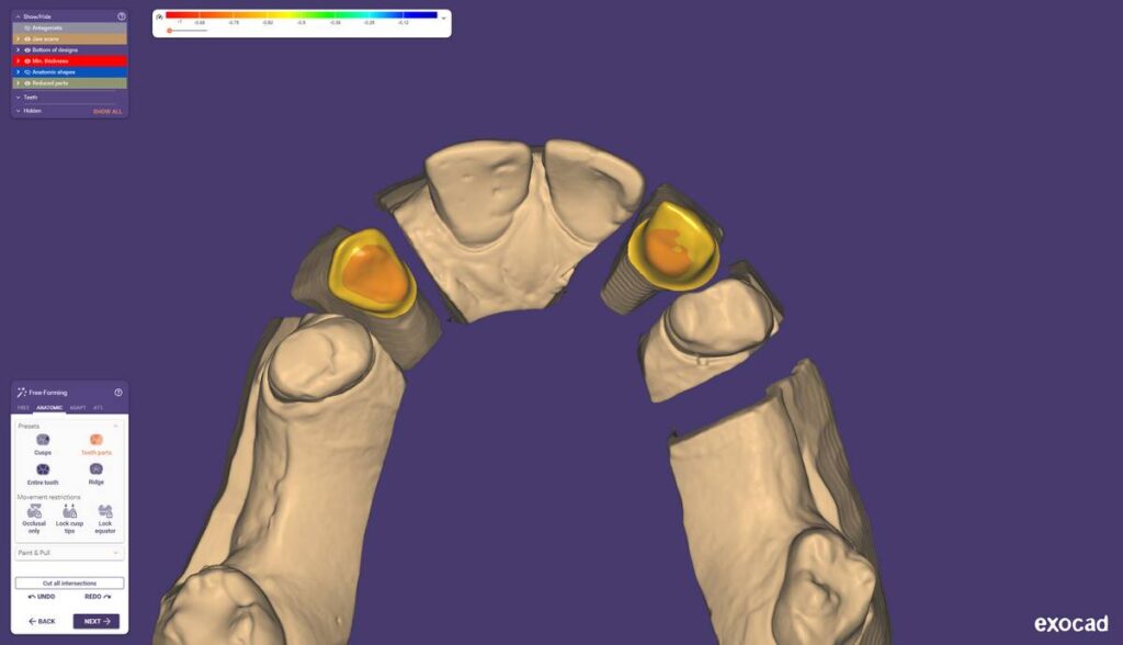 agnieszka dudzinska protetyk stomatologiczny olsztyn 04