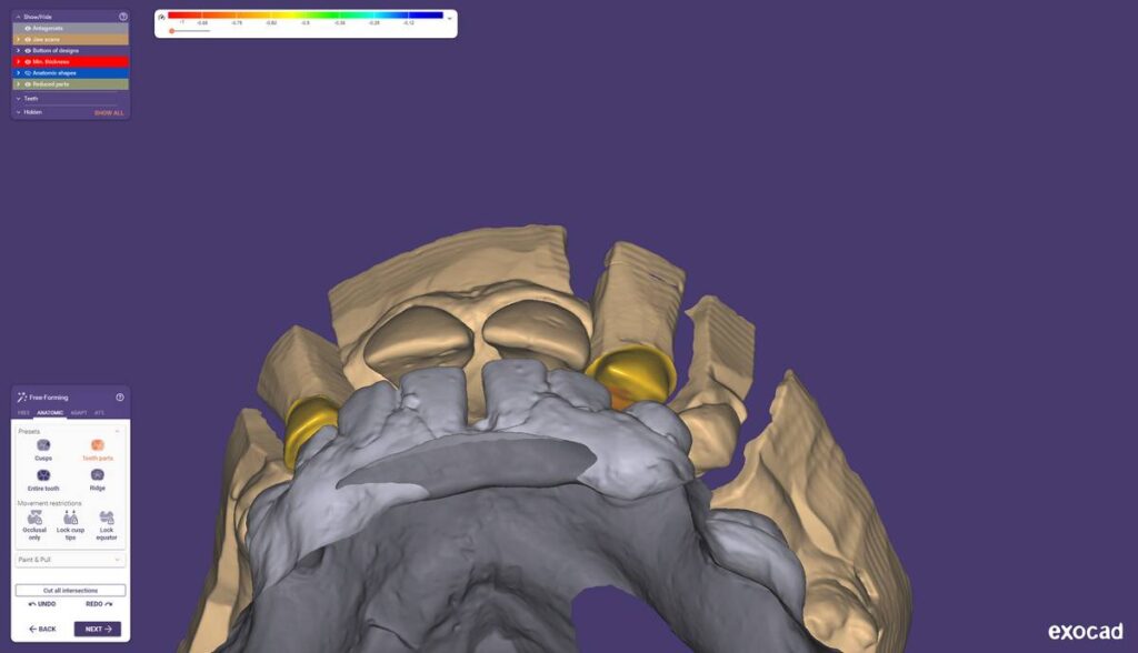 agnieszka dudzinska protetyk stomatologiczny olsztyn 05