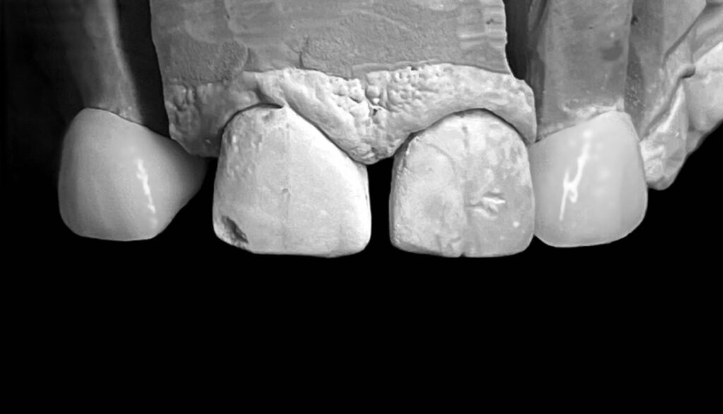 agnieszka dudzinska protetyk stomatologiczny olsztyn 08