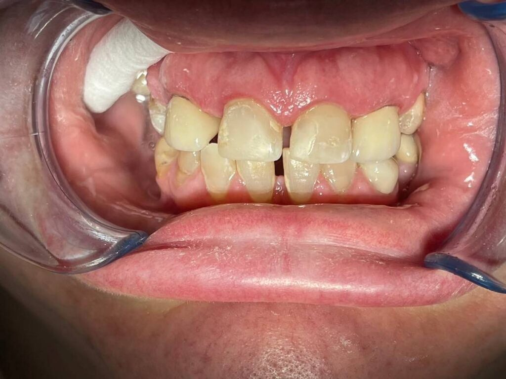 agnieszka dudzinska protetyk stomatologiczny olsztyn 09