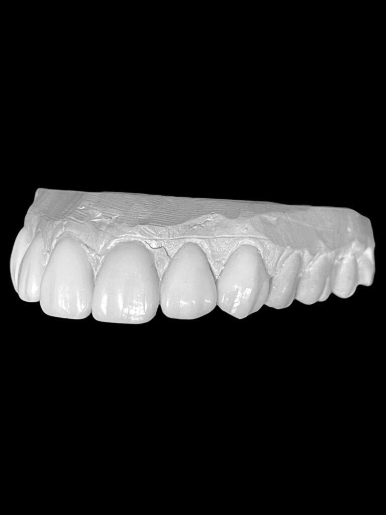 agnieszka dudzinska protetyk stomatologiczny waxup olsztyn 01