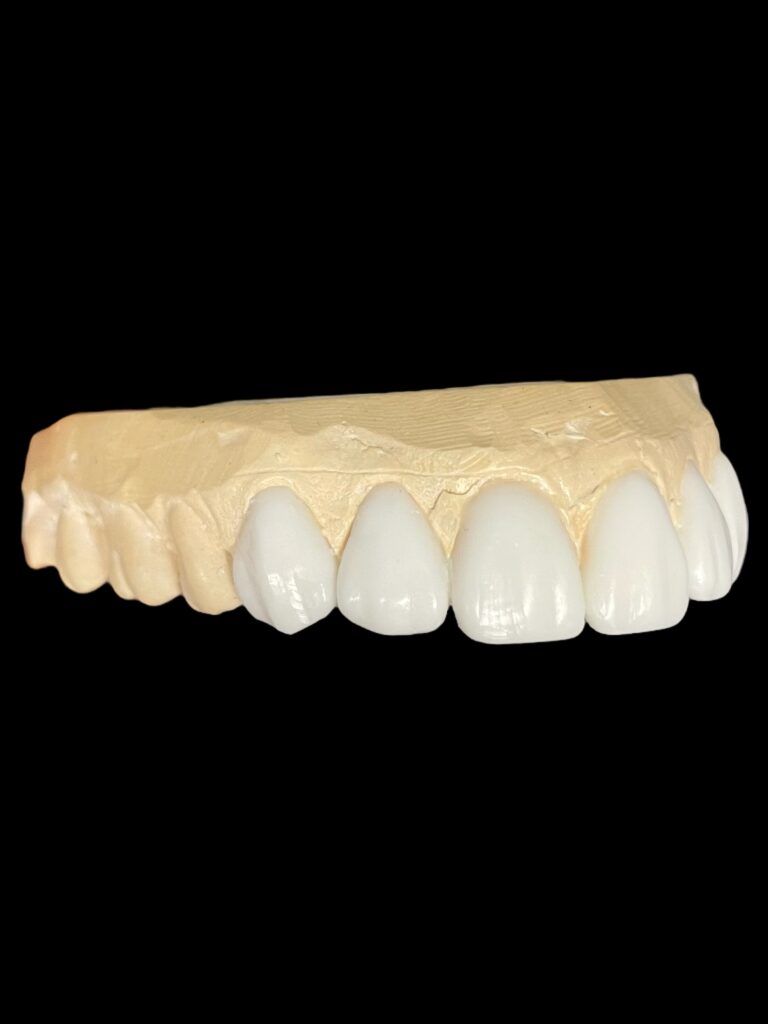 agnieszka dudzinska protetyk stomatologiczny waxup olsztyn 05