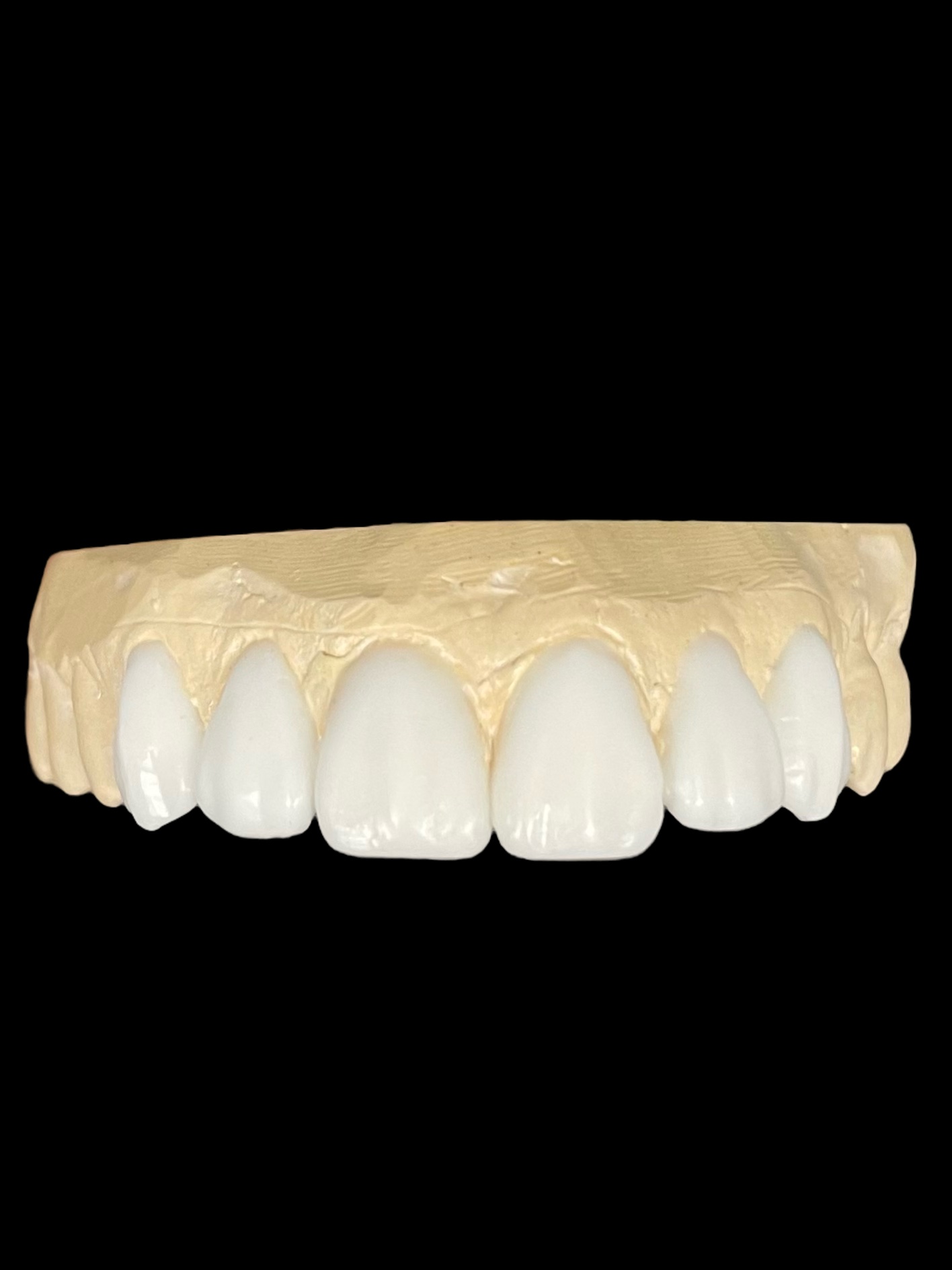 agnieszka dudzinska protetyk stomatologiczny waxup olsztyn 10