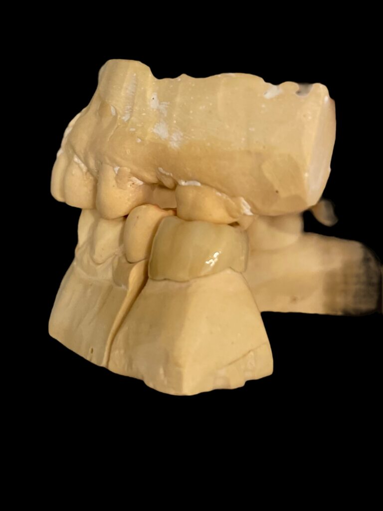 agnieszka dudzinska protetyk stomatologiczny inne portfolio olsztyn 02