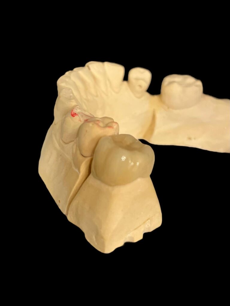 agnieszka dudzinska protetyk stomatologiczny inne portfolio olsztyn 03