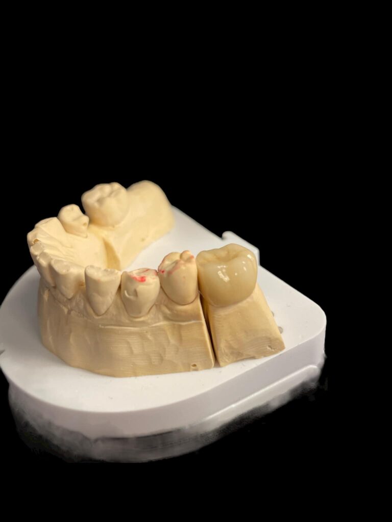 agnieszka dudzinska protetyk stomatologiczny inne portfolio olsztyn 04