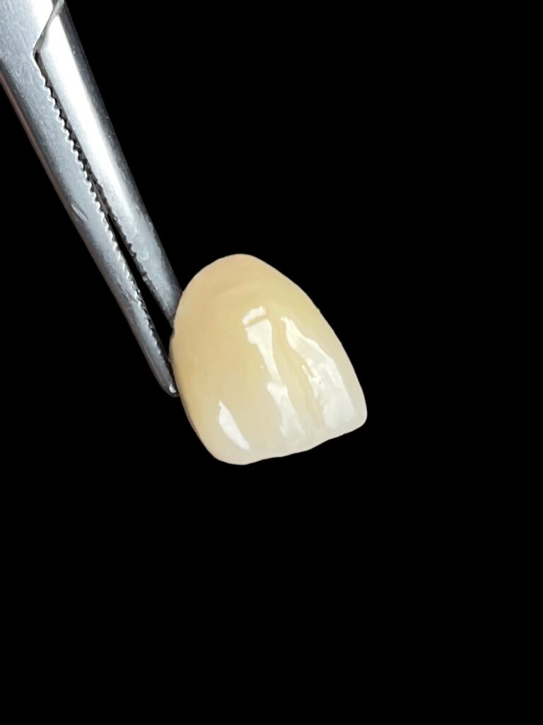 agnieszka dudzinska protetyk stomatologiczny inne portfolio olsztyn 05