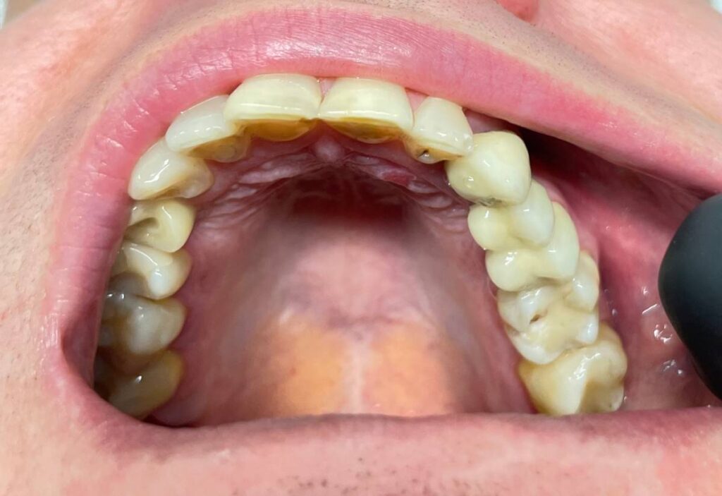 agnieszka dudzinska protetyk stomatologiczny opinia olsztyn 02