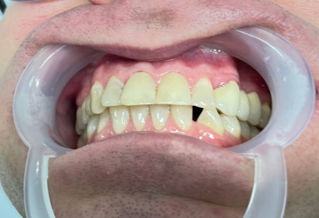 agnieszka dudzinska protetyk stomatologiczny opinia olsztyn 03